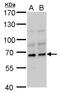 Dual Specificity Phosphatase 8 antibody, GTX115561, GeneTex, Western Blot image 