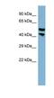 Proline Rich 5 Like antibody, NBP1-57689, Novus Biologicals, Western Blot image 