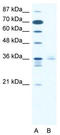 LIM Homeobox 3 antibody, TA330541, Origene, Western Blot image 