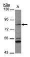 Phosphate Regulating Endopeptidase Homolog X-Linked antibody, LS-C185756, Lifespan Biosciences, Western Blot image 