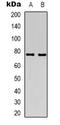 AceCS2 antibody, LS-C368684, Lifespan Biosciences, Western Blot image 