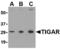 TP53 Induced Glycolysis Regulatory Phosphatase antibody, MBS150794, MyBioSource, Western Blot image 
