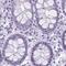 MORC Family CW-Type Zinc Finger 4 antibody, PA5-53320, Invitrogen Antibodies, Immunohistochemistry frozen image 