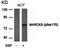 ABL Proto-Oncogene 1, Non-Receptor Tyrosine Kinase antibody, orb15007, Biorbyt, Western Blot image 