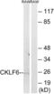 CKLF Like MARVEL Transmembrane Domain Containing 6 antibody, abx014369, Abbexa, Western Blot image 