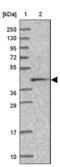 Calreticulin-3 antibody, NBP2-33524, Novus Biologicals, Western Blot image 
