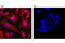 Vimentin antibody, 9855S, Cell Signaling Technology, Immunocytochemistry image 