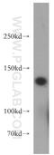 Diacylglycerol Kinase Kappa antibody, 20090-1-AP, Proteintech Group, Western Blot image 