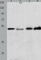 Endothelin Receptor Type B antibody, TA322809, Origene, Western Blot image 