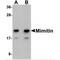 Mimitin, mitochondrial antibody, MBS150314, MyBioSource, Western Blot image 