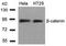 CTNNB1 antibody, AP02721PU-S, Origene, Western Blot image 