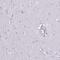 VSP antibody, HPA047737, Atlas Antibodies, Immunohistochemistry paraffin image 