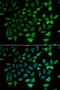 CAC antibody, PA5-77053, Invitrogen Antibodies, Immunofluorescence image 
