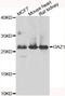 Ornithine decarboxylase antizyme 1 antibody, abx006957, Abbexa, Western Blot image 