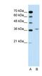 Aminolevulinate Dehydratase antibody, NBP1-56507, Novus Biologicals, Western Blot image 