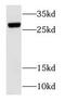 RAB3C, Member RAS Oncogene Family antibody, FNab07027, FineTest, Western Blot image 