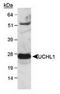 Ubiquitin C-Terminal Hydrolase L1 antibody, TA301477, Origene, Western Blot image 