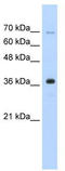 Zinc Finger RANBP2-Type Containing 2 antibody, TA339113, Origene, Western Blot image 