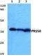 Serine Protease 8 antibody, A05561, Boster Biological Technology, Western Blot image 