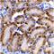 DNA Fragmentation Factor Subunit Beta antibody, GTX31257, GeneTex, Immunohistochemistry paraffin image 