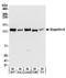 Exportin 5 antibody, A303-991A, Bethyl Labs, Western Blot image 