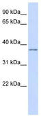 Potassium Voltage-Gated Channel Subfamily A Regulatory Beta Subunit 2 antibody, TA338755, Origene, Western Blot image 