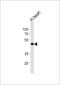 Potassium Voltage-Gated Channel Subfamily A Member Regulatory Beta Subunit 1 antibody, 60-531, ProSci, Western Blot image 