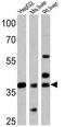 Forkhead Box A3 antibody, GTX79266, GeneTex, Western Blot image 