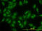 DnaJ homolog subfamily C member 10 antibody, LS-B11250, Lifespan Biosciences, Immunofluorescence image 