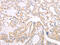 Von Hippel-Lindau Tumor Suppressor antibody, CSB-PA071125, Cusabio, Immunohistochemistry paraffin image 