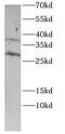MTOR Associated Protein, LST8 Homolog antibody, FNab10372, FineTest, Western Blot image 
