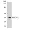 Zinc transporter ZIP1 antibody, LS-C200691, Lifespan Biosciences, Western Blot image 