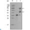 Ret Proto-Oncogene antibody, LS-C812840, Lifespan Biosciences, Western Blot image 