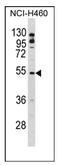 BLNK antibody, AP17153PU-N, Origene, Western Blot image 