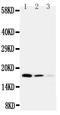Cystatin C antibody, PA1369, Boster Biological Technology, Western Blot image 