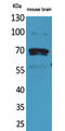 Bridging Integrator 1 antibody, STJ96681, St John