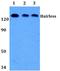 Protein hairless antibody, PA5-37443, Invitrogen Antibodies, Western Blot image 