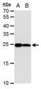 Triosephosphate Isomerase 1 antibody, MA5-18291, Invitrogen Antibodies, Western Blot image 