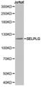 P-selectin glycoprotein ligand 1 antibody, TA327127, Origene, Western Blot image 