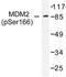 Hdm2 antibody, LS-C177978, Lifespan Biosciences, Western Blot image 