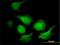 Adenylate kinase isoenzyme 1 antibody, H00000203-M01, Novus Biologicals, Immunocytochemistry image 