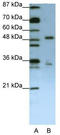 Regulator of nonsense transcripts 3B antibody, TA343922, Origene, Western Blot image 