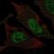 T Cell Leukemia Homeobox 3 antibody, NBP2-68767, Novus Biologicals, Immunocytochemistry image 