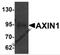 Axin 1 antibody, 6005, ProSci Inc, Western Blot image 
