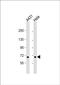 Coiled-coil domain-containing protein 120 antibody, PA5-48562, Invitrogen Antibodies, Western Blot image 