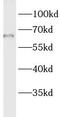 Lipase Maturation Factor 1 antibody, FNab04805, FineTest, Western Blot image 