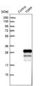Testis Development Related Protein antibody, NBP1-93675, Novus Biologicals, Western Blot image 