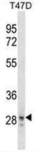 Zinc finger protein SNAI3 antibody, AP53956PU-N, Origene, Western Blot image 