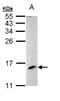 Late Endosomal/Lysosomal Adaptor, MAPK And MTOR Activator 3 antibody, PA5-22145, Invitrogen Antibodies, Western Blot image 