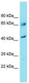 Family With Sequence Similarity 83 Member A antibody, TA335330, Origene, Western Blot image 